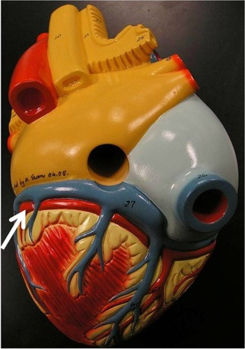 <p>circumflex artery</p>