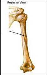 <p>furrow/ narrow depression</p><p>ex: radial ___ of humerus</p>