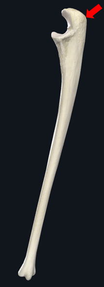 <p>Name the specific part of the bone in color</p>