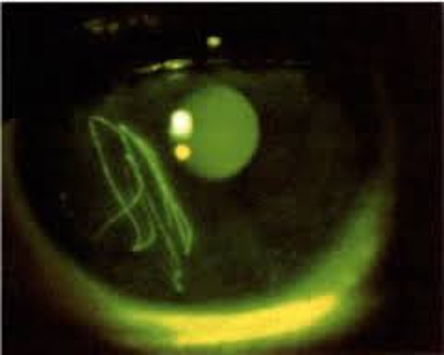 <p>or mechanical trauma can present in various ways, such as a zigzag-shaped abrasion or as the outline shape of an embedded foreign body.</p>