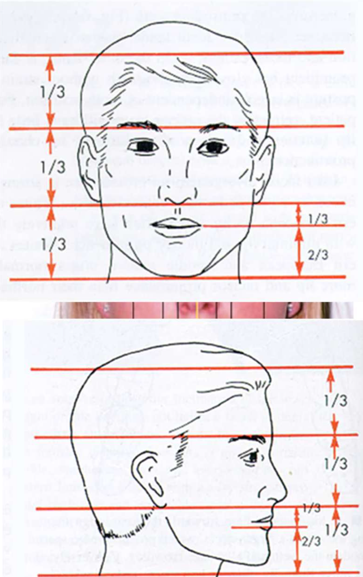 <p>vertical facial thirds </p>