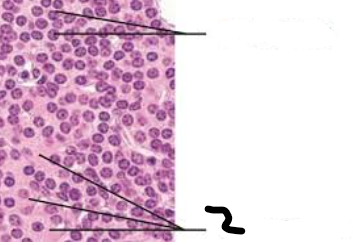 <p>Large Pale staining cells with visable nucleus </p>