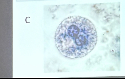 <p>What is this organism?</p>