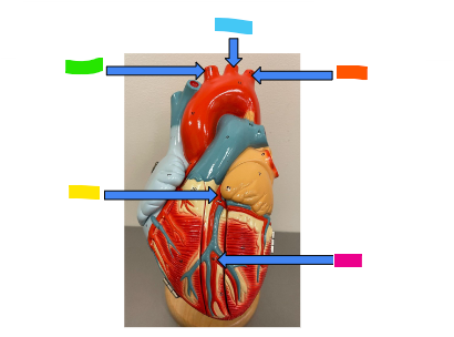 <p>What is the orange arrow?</p>