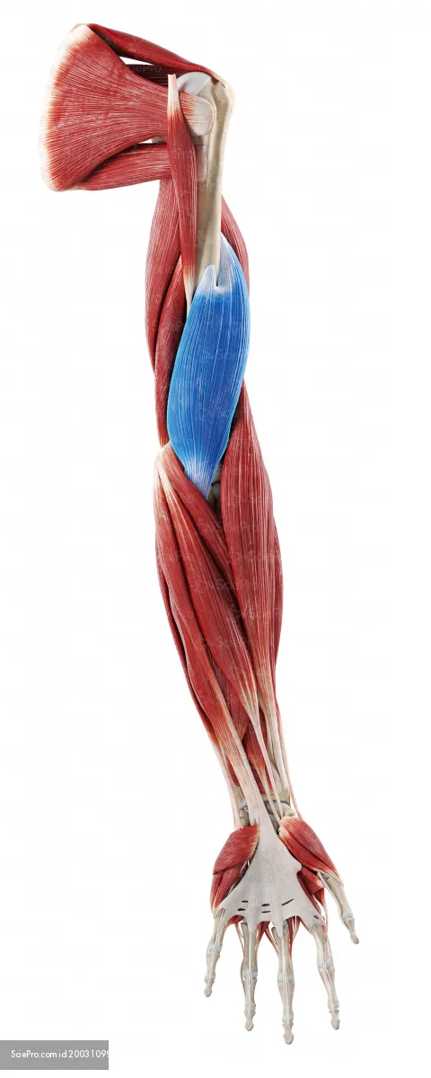 term image