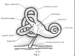 <p>Small rocks of limestone (CaCO3) that are only supposed to live in utricle + saccule, it ends up in semicircular canals and causes BPPV.</p>