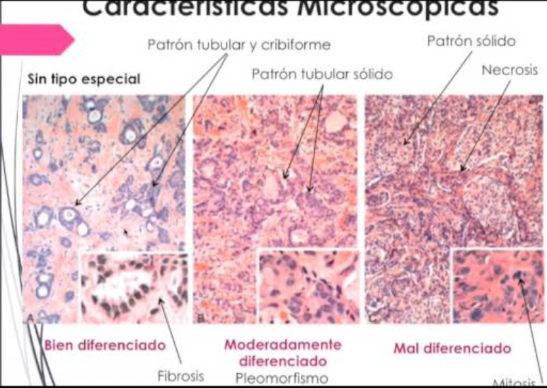 <p>El cancer de mama puede ser esporádico o hereditario, mutaciones en los genes supresores aumentan el riesgo de sufrirlo, cual gen esta relacionado con <strong>cancer hereditario:</strong></p>