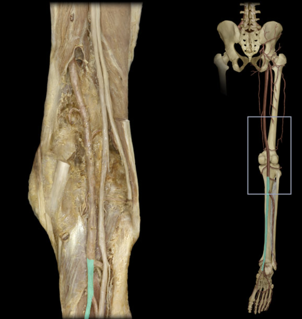 <p>Identify the blood vessel of the lower extremity</p>