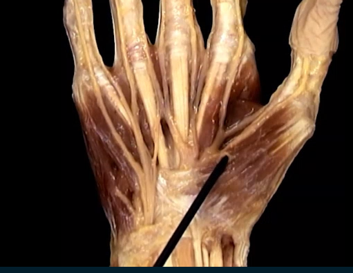 <p>Oppervlakkig, Handpalm</p>