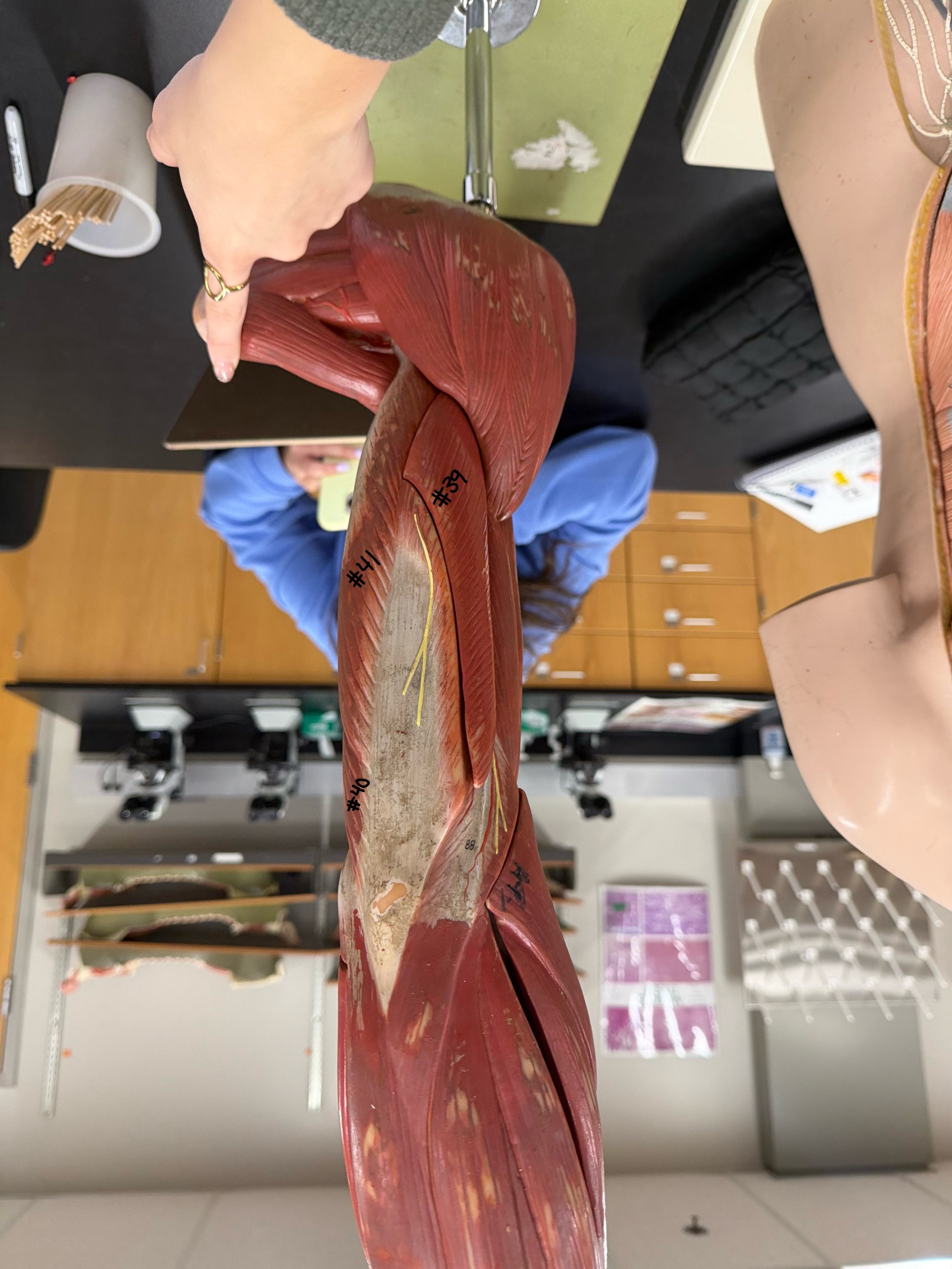 <p>What part of Triceps Brachii is labeled #40?</p>