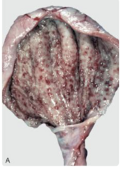<p>What is being shown on this gross image?</p>