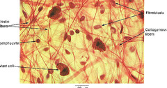 <p>Yellow Fibers</p>