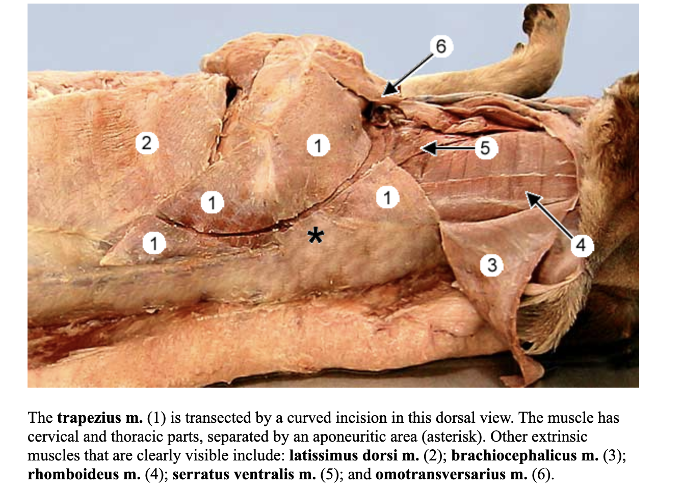 <p>separated into pars cervicalis & pars mastoidea</p>