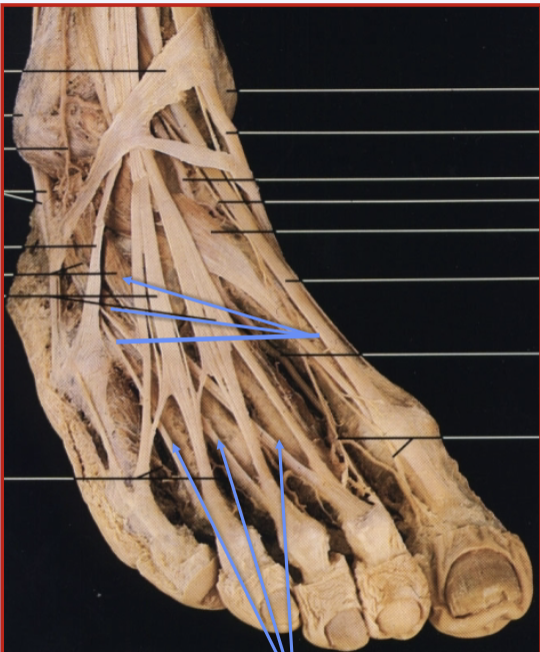 <p>What muscle, action and innervation is this?</p>