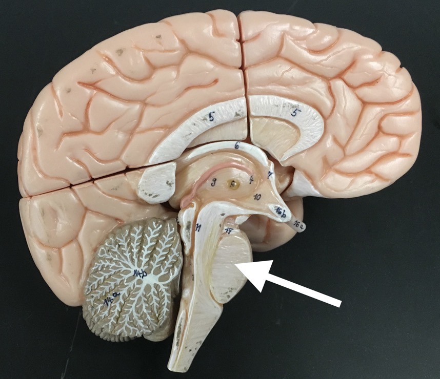 <p>What is the arrow pointing to?</p>