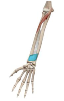 <p>what muscle and action is this </p>