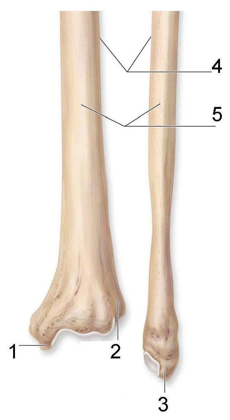 <p>What is identified in the photo (#1–#5)</p>