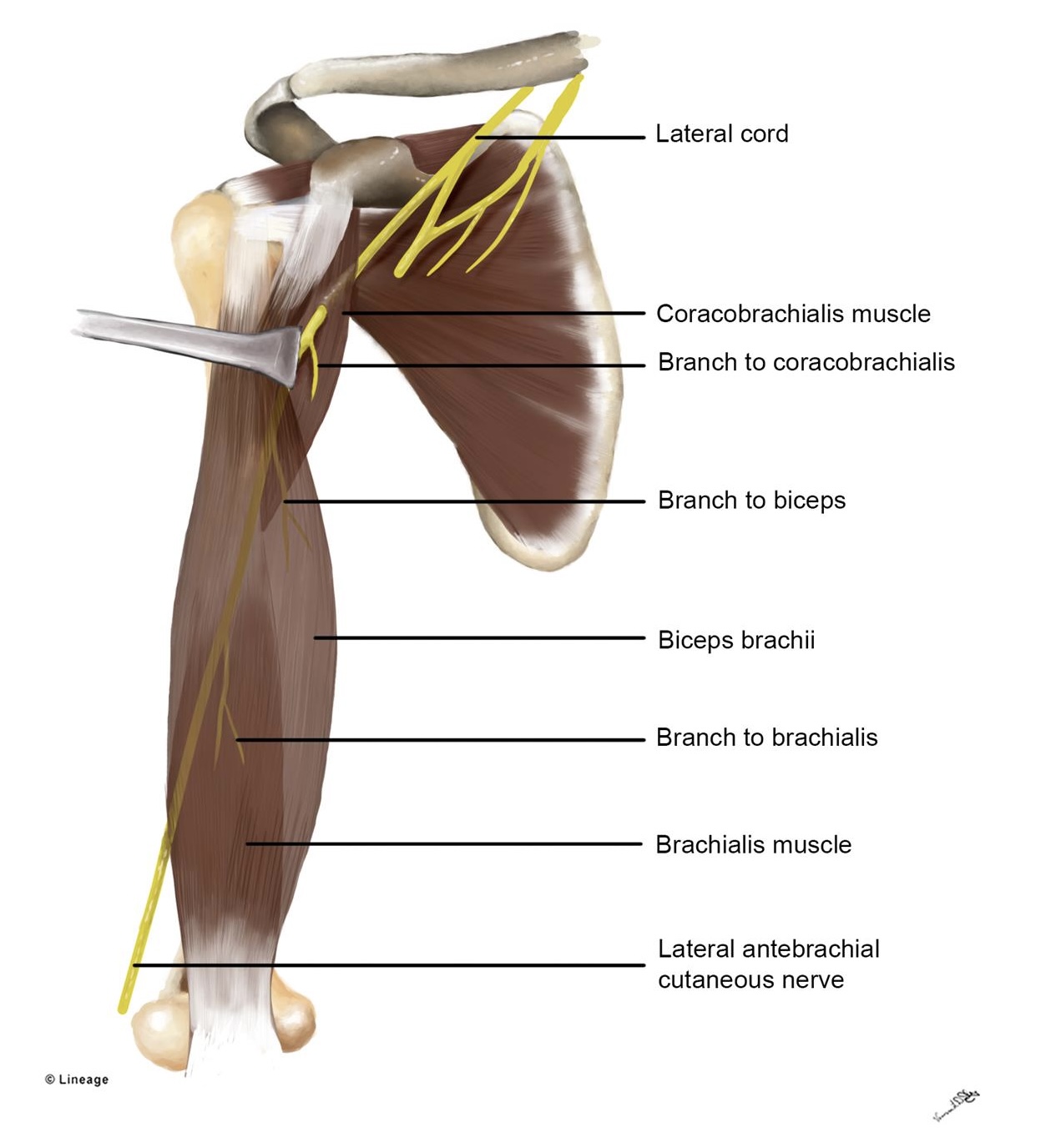 <p>a major peripheral nerve of the upper limb originating from spinal nerve roots C5, C6, and C7 through the brachial plexus. It provides motor control to the front arm muscles (coracobrachialis, biceps brachii, and brachialis) and sensory feeling to the lateral forearm.</p>