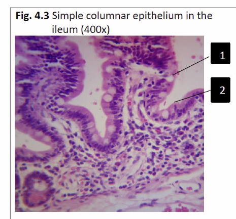 <p><span style="background-color: transparent;">epithelial tissue that is most suited to </span></p><p><span style="background-color: transparent;">Secretion, absorption &amp; chemical protection</span></p>