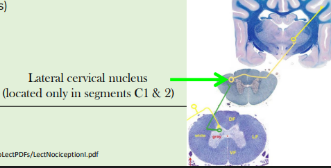 <p>Spinocervicothalamic tract (spinocervical) - stops in cervical region</p><p></p><p>Important <strong>(most) in cats and dogs - carnivores</strong></p><p></p><p>Concerned with the transmission of superficial pain and tactile sensations, <strong>considered the primary conscious pathway</strong> in carnivores</p><p></p><p>(Spinoreticular tract is primarily concerned with deep pain and visceral sensations)</p><p></p><p>synpases at lateral cervical nucleus then it will cross</p><p></p><p>First order neurons: Spinal Ganglion</p><p></p><p>Second-order neurons: Marginal Nucleus or Nucleus Proprius</p><p></p><p>Axons of these second-order neurons <strong>ascend ipsilaterally to the upper cervical spinal cord to synapse on third-order neurons</strong> located in the lateral cervical nucleus</p><p></p><p>Axons from <strong>third-order neuron</strong>s in the lateral cervical nucleus cross the midline and ascend to the contralateral thalamus to terminate on<strong> fourth- order neurons</strong></p><p></p><p>Axons of the fourth- order neurons project to the cerebral cortex</p>