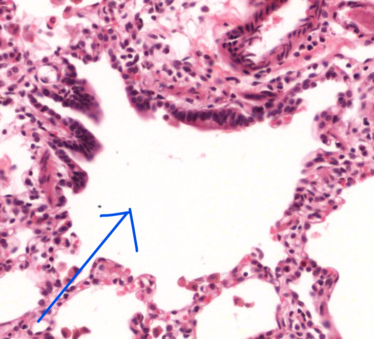 <p>identify the organ </p>