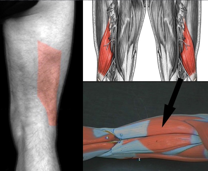 <p>What muscle is this?</p>