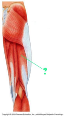 <p>Identify the indicated muscle.</p>