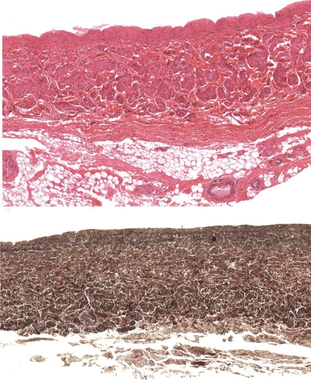 <p>Idenitfy the Vessel and what are the Properties?</p>