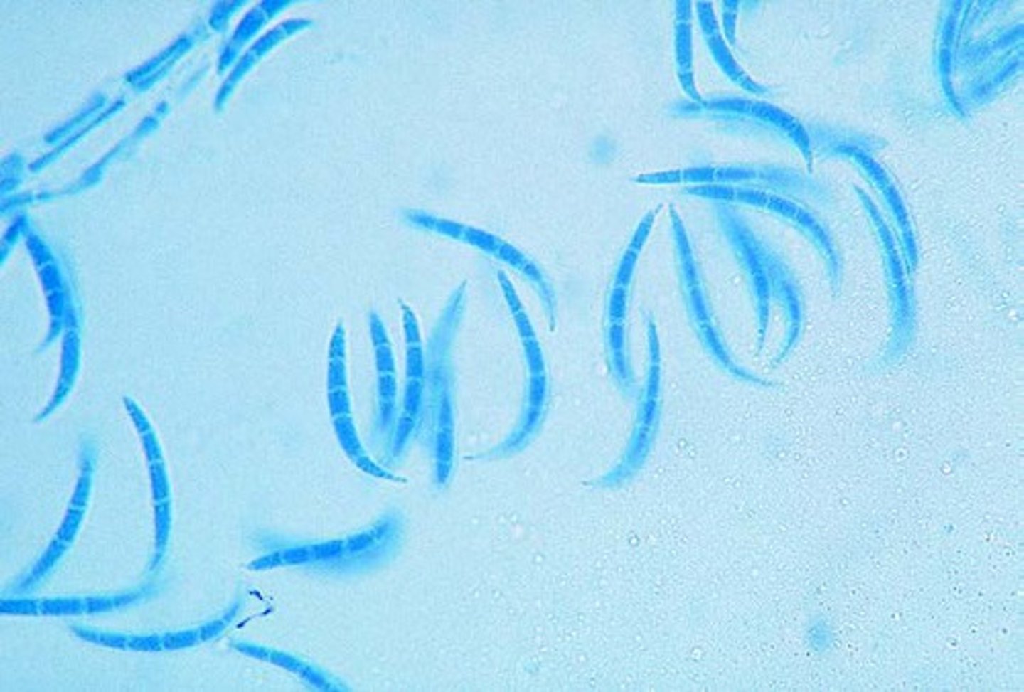 <p>Macroconidia are banana-shaped</p>