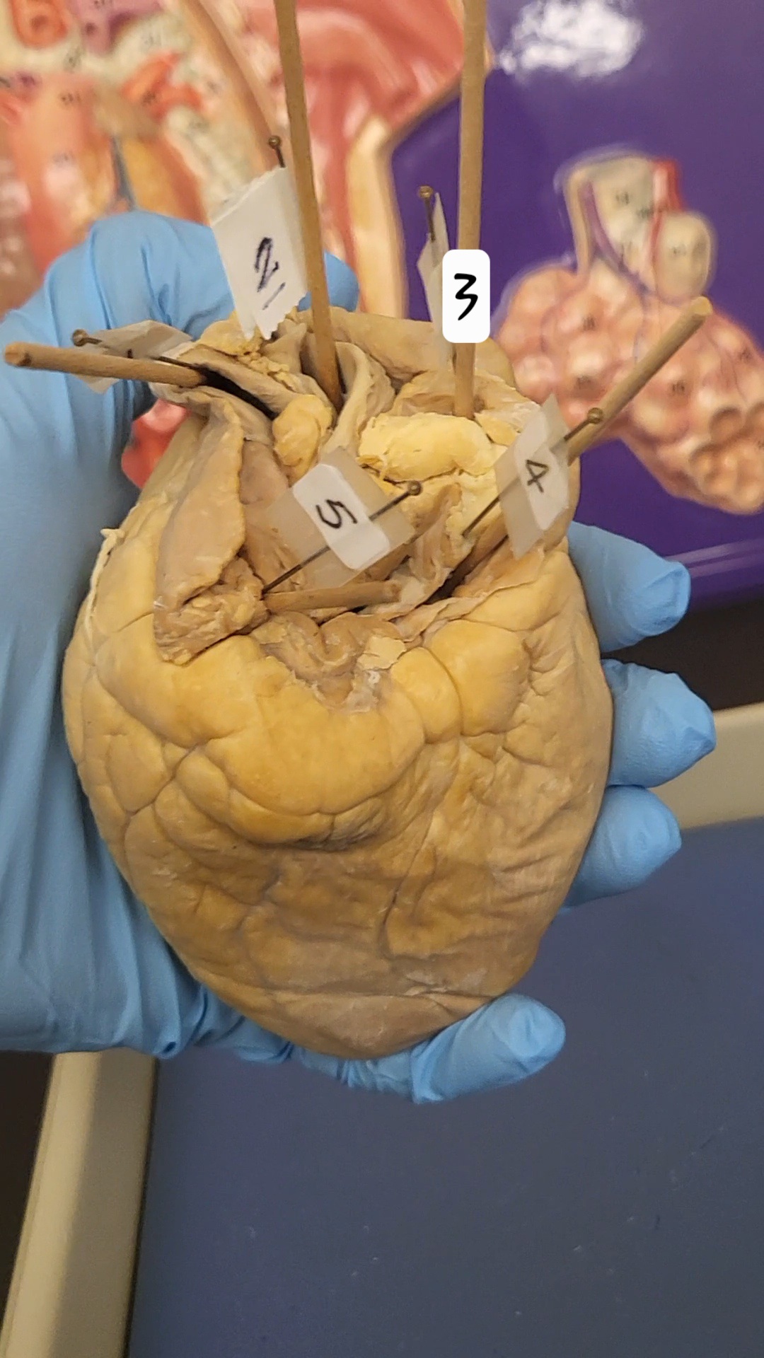 <p>identify 2</p>