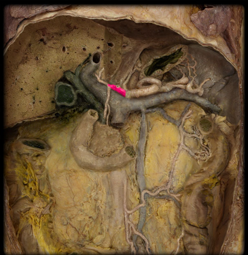 <ul><li><p><strong>Origin: </strong>Celiac artery</p></li><li><p><strong>Course: </strong></p><ul><li><p>Passes anterior and to the right to enter lesser omentum</p></li><li><p>Ends at superior border of first (superior) part of duodenum</p></li></ul></li><li><p><strong>Distribution: </strong>Liver, Pancreas, Stomach. Gallbladder, and Duodenum</p></li><li><p><strong>Branches: </strong>Hepatic artery proper and Gastroduodenal</p></li></ul><p></p>