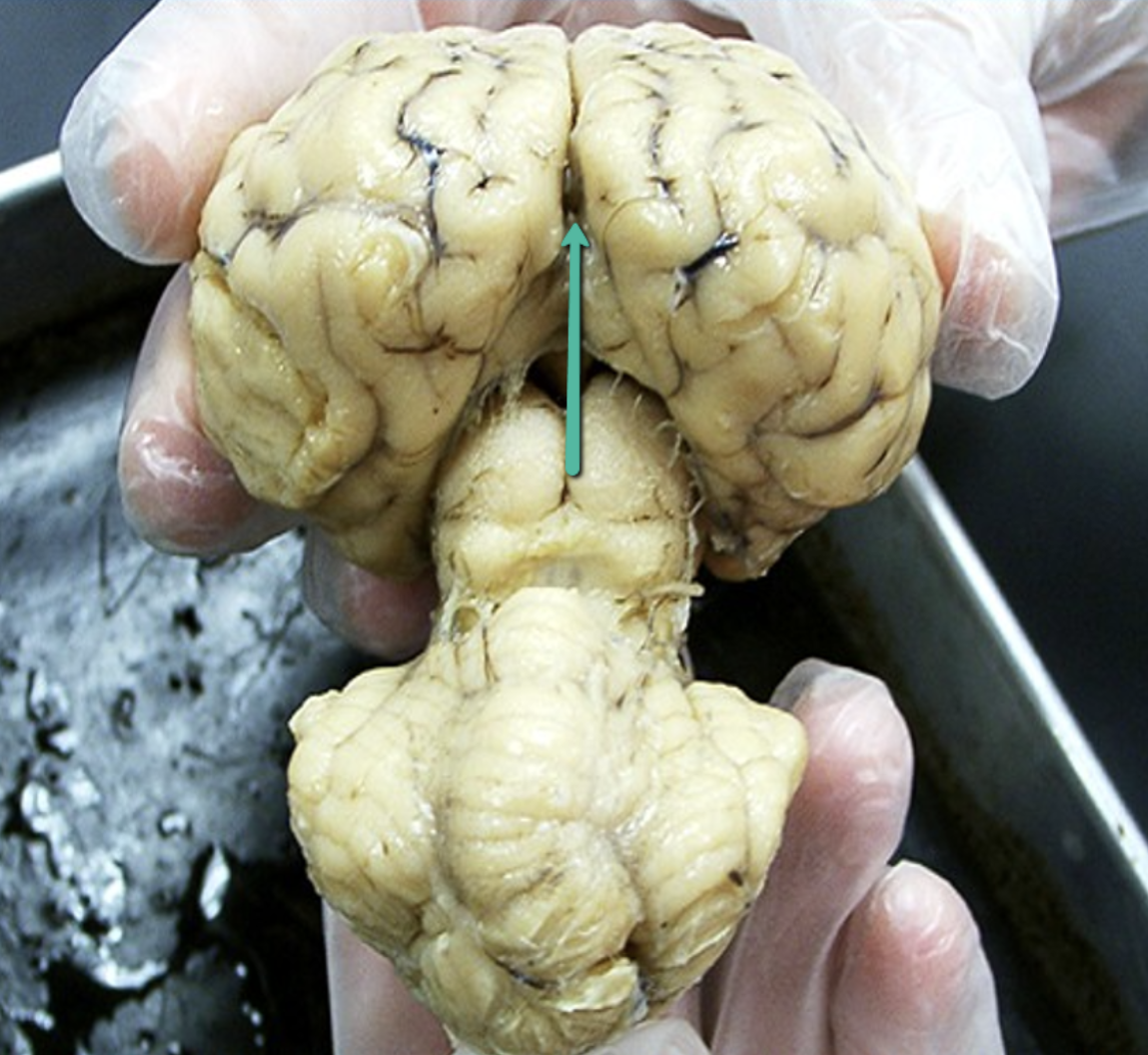 <p>Identify the structure indicated by the pointer.</p>