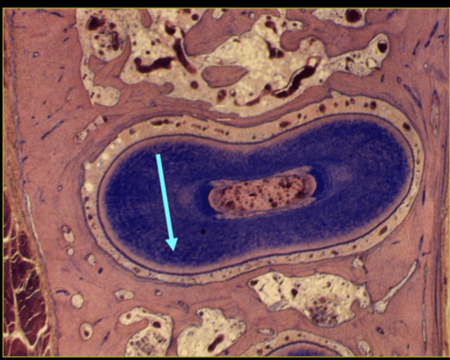<p>ID phase of tooth movement:</p>