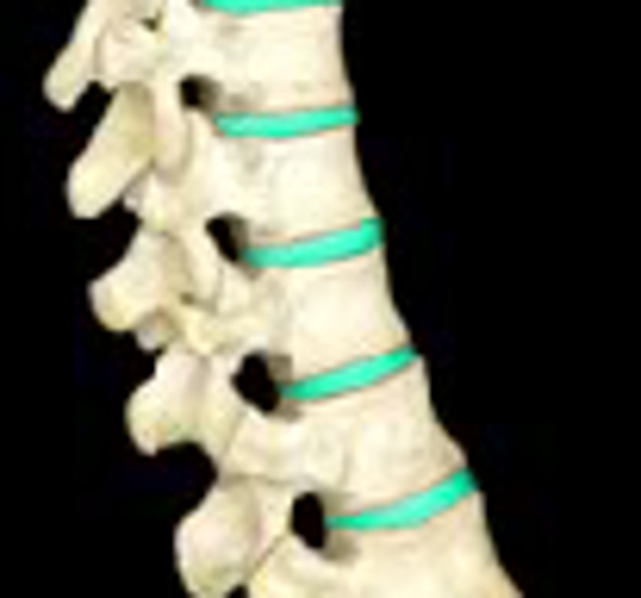 <p>Tough, elastic structures between adjoining vertebrae that act as shock absorbers</p>