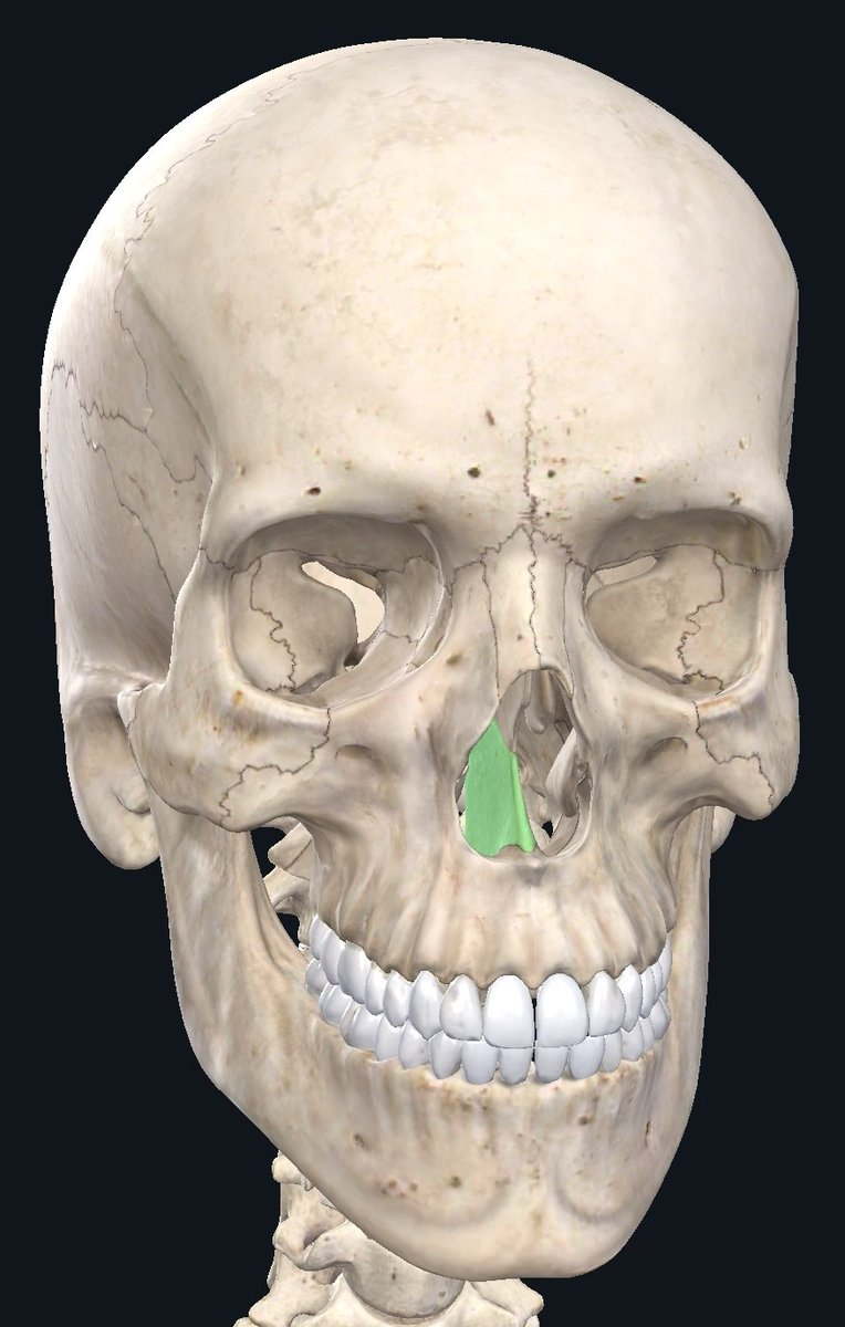 <p>Inferior nasal septum</p>