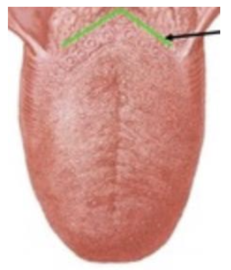 <p>Question #: 61 What structure can be identified by the green line on the provided figure? <br>A. Terminal sulcus <br>B. Copula <br>C. Hypopharyngeal eminence <br>D. Tublerculum impar</p>