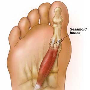 <p><span>Two small, pea-shaped bones located under the big toe joint, embedded within tendons, that act as pulleys and absorb pressure</span></p>
