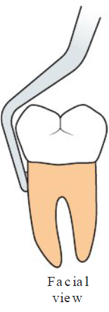 <p><strong>Lingual surface w/ proximal view</strong></p><ul><li><p>Front to back shank — working ends reach around crown and onto lingual and facial surfaces of the root</p></li></ul><p></p><p><strong>Proximal surface w/ facial view</strong></p><ul><li><p>Side to side shank — working end reach around crown and onto proximal (mesial and distale) surfaces of the tooth</p></li></ul><p></p>