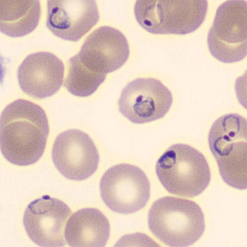<p>Identify</p>