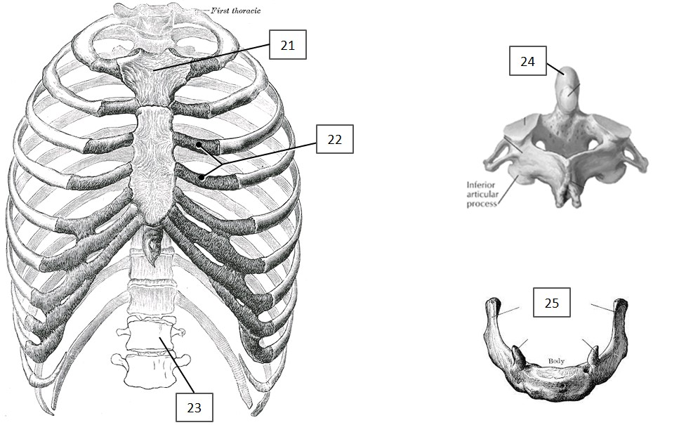 <p>(24) Which of these is indicated?</p>