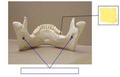 <p>Posterior View of Mandible</p>