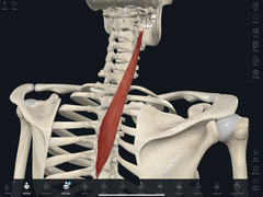 <p>extends and rotates the neck</p>