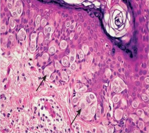 term image
