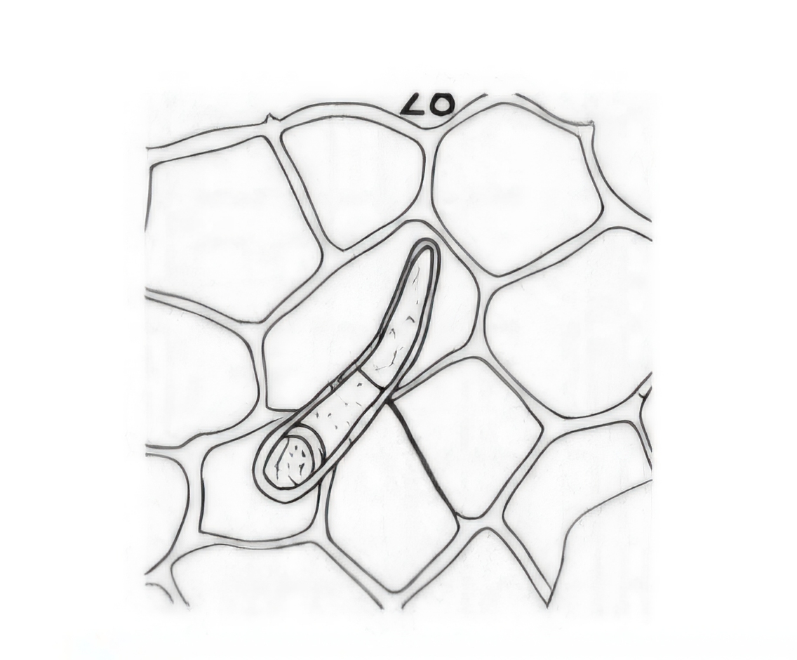<p>What is this structure? What fruit does it belong to?</p>