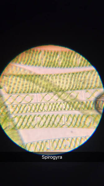 <p>Filamentous green alga (long unbranched chain of cells)</p>