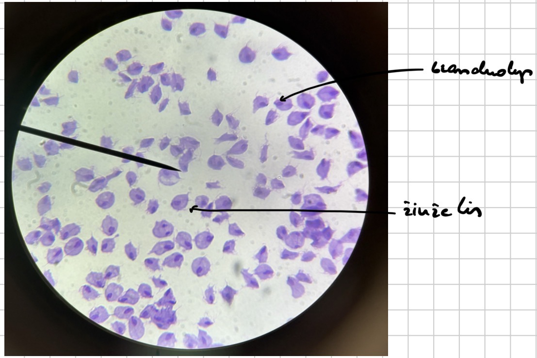 <p>Makstine trifomona - triphomona vaginalis</p>