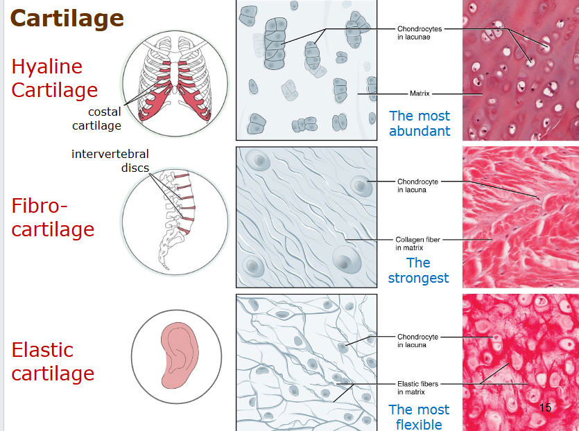<p>hyaline cartilage - most abundant, costal or trachea</p><p>fibro cartilage - strongest, intervertebral discs</p><p>elastic cartilage - most flexible, in ear</p><p>CHONDROCYTES - cell</p>