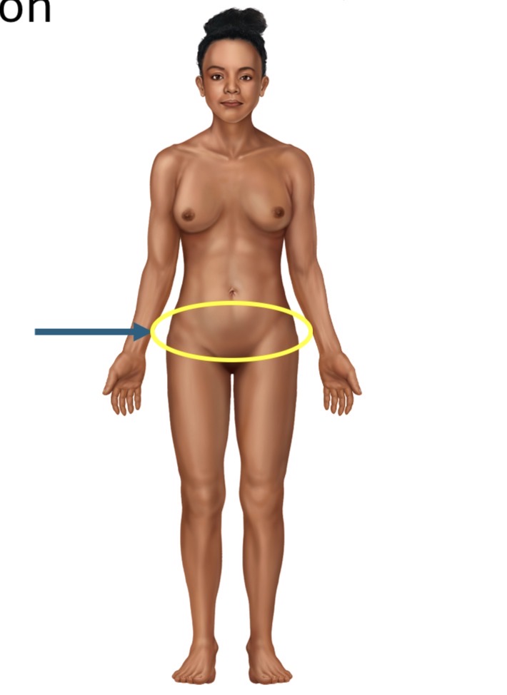 <p>Name the body part or region</p>