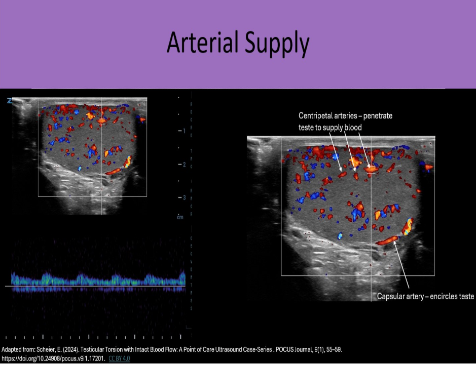 <p>A. centripetal</p><p>Capsular artery courses along the testicle periphery and produces branches called centripetal arteries which course through the parenchyma. The deferential artery supplies vas deferens and epididymis with blood. The cremasteric artery supplies scrotal sac with blood.</p>