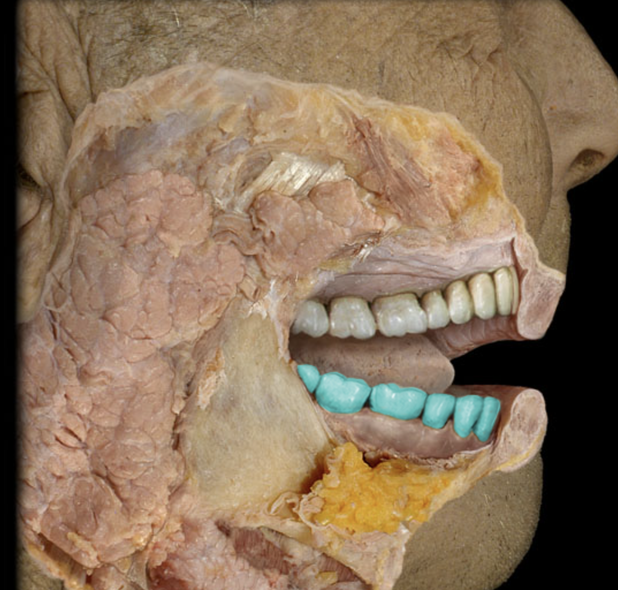 term image